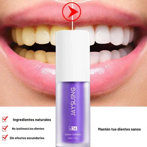 WhiteSmileⓇ Blanqueador dental V34 ---PAGA 1 LLEVA 2----