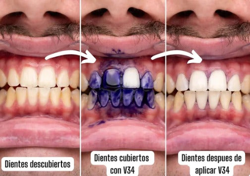 WhiteSmileⓇ Blanqueador dental V34 ---PAGA 1 LLEVA 2----